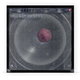 NEIGHBOURHOOD – ((((((ultraSOUND)))))+ (INDIE EXCLUSIVE MAUVE VINYL) 2LP <br>PREORDER out 2/20/2026 •
