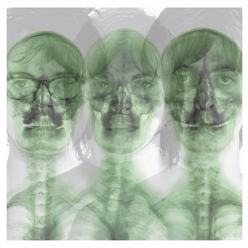 SUPERGRASS – SUPERGRASS (2CD) - CD •